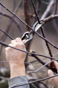 VIO脱毛で黒ずみ改善が期待できる理由は？